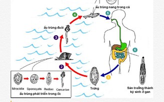 Bệnh nguy hiểm do thói quen ăn gỏi cá sống