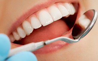 Sâu răng tăng nguy cơ đột quỵ