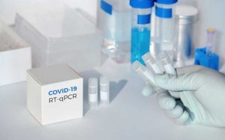 Có một cách để chẩn đoán Covid-19, ngoài test nhanh hoặc PCR