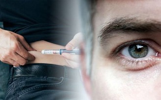 Dấu hiệu ở mí mắt tiết lộ bạn có thể mắc bệnh tiểu đường