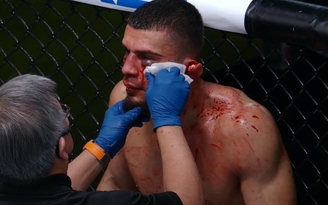 Võ sĩ UFC dính chấn thương 'rùng rợn' trong trận đấu ra mắt