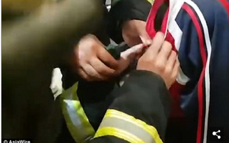 Cậu bé bị kẹt mí mắt trong dây kéo áo khoác, lính cứu hỏa cũng bó tay