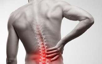 4 cơn đau lưng là dấu hiệu của viêm cột sống dính khớp