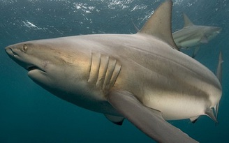 Chiếc răng cá mập 'mắc kẹt' trong chân người đàn ông 25 năm