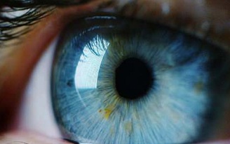 Bị tạt a xít mù mắt, nhờ liệu pháp tế bào gốc mới bệnh nhân đã sáng mắt