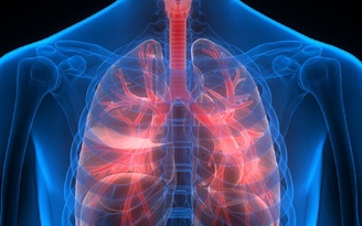 4 triệu chứng của bệnh phổi có thể không phải do Covid-19 gây ra