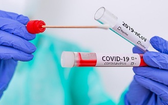 Một bệnh nhân tái nhiễm Covid-19 trong thời gian 20 ngày