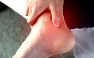4 dấu hiệu đau cổ chân cảnh báo là do bệnh gout