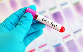 79 người ở TP.HCM nhiễm vi rút Zika