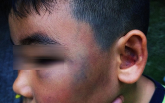 Nóng mạng xã hội: Phẫn nộ khi bé trai 8 tuổi bị đánh khi đang nghịch với đàn gà