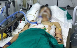 Đưa hết tài sản xin tha mạng, tài xế xe ôm vẫn bị cướp đâm