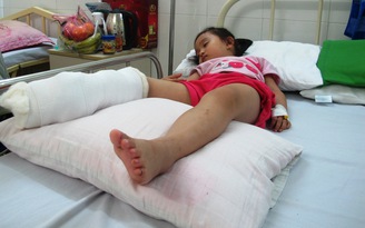 Mặc người cha van xin, côn đồ bịt mặt chém đứt gân chân bé gái 4 tuổi