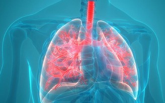 Ngày mới với tin tức sức khỏe: Ảnh hưởng lâu dài của Covid-19 đối với phổi