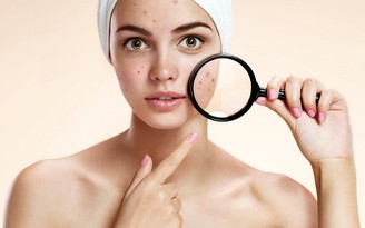 Hướng dẫn các bước skincare cho da mụn hiệu quả ngay tại nhà