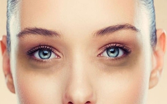 Mách bạn thêm 1 cách trị thâm quầng mắt hiệu quả mà lại rẻ bèo