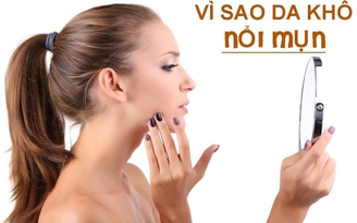 Quy trình chuẩn chữa lành vết thương mụn cho da khô