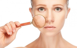 Trị nám bằng chanh kết hợp kem dưỡng da liệu có cải thiện được làn da nám?
