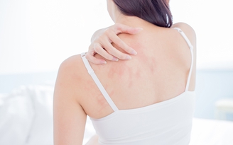 Xóa tan nỗi ám ảnh bệnh ngoài da