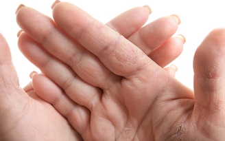 Dù rửa xà phòng hay dùng gel khô, chọn sai một li là ‘cô vi’ đến đấy