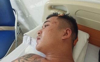 Đắk Lắk: Công an xã bị tố vô cớ đánh người đến nhập viện
