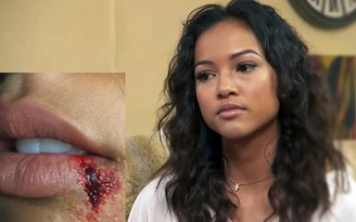 Fan lo lắng người đẹp gốc Việt lại bị Chris Brown hành hung
