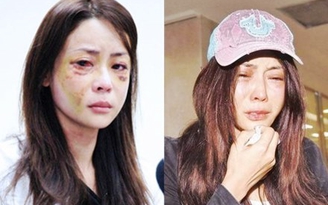 Mỹ nhân Hoa ngữ 'chết đi sống lại' vì bị chồng đại gia bạo hành