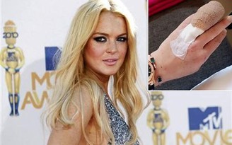 Lindsay Lohan mất nửa ngón tay trong tai nạn thuyền