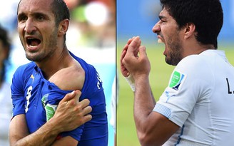 Hậu vệ tuyển Ý Chiellini hé lộ sự ngưỡng mộ cú “cẩu xực” của Suarez