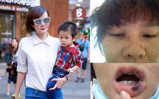 Dương Yến Ngọc: 'Một tuần bị chồng đánh 2 lần, mỗi lần 3,4 tiếng'