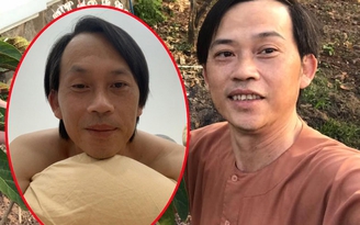 Nghệ sĩ Hoài Linh hé lộ gương mặt 'cháy nắng' sau thời gian 'ở ẩn' làm nông