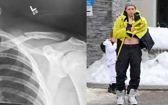 Con trai cả của David Beckham gãy xương đòn khi trượt tuyết