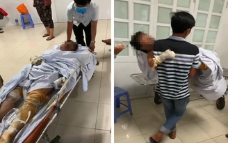 Phóng hỏa đốt nhà ở Phú Yên: Khởi tố, bắt giam bị can Trần Văn Phúc