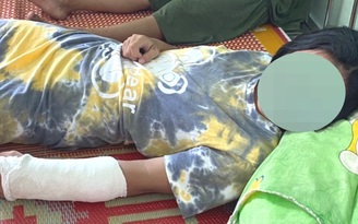 Phú Yên: Nữ sinh lớp 7 bị anh trai của bạn vào trường đánh gãy tay