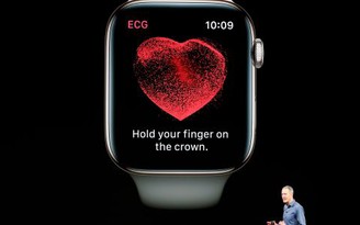 Bác sĩ tim mạch giải thích lý do lo lắng về mẫu Apple Watch mới