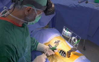 Khám phá bộ kính thực tế tăng cường dành cho bác sĩ phẫu thuật