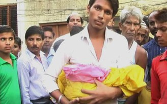 Ấn Độ: Bác sĩ 'để quên’ phần đầu thai nhi trong bụng mẹ