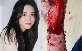 Mina đăng ảnh cắt cổ tay, dằn mặt thành viên AOA và chủ cũ