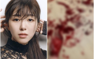 Nữ ca sĩ xinh đẹp Mina đăng ảnh máu me, nghi tự tử khiến fan hoang mang