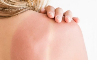Tác hại khó lường của ánh nắng mặt trời