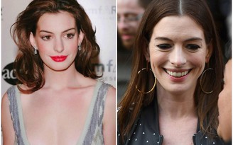 'Công chúa' Anne Hathaway gây sốc với gương mặt già nua, xuống sắc