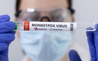 Mỹ ghi nhận ca tử vong đầu tiên liên quan bệnh đậu mùa khỉ
