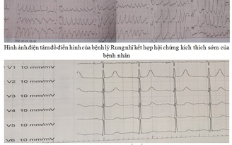 Cứu sống bệnh nhân 'tim đập 300 lần/phút'