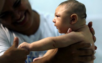 Thai phụ Việt Nam cần đối phó với vi rút Zika như thế nào?