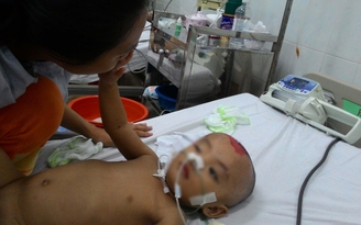 Trẻ 13 tháng tuổi bị chấn thương sọ não ở nhà trẻ: Cháu đã nắm tay mẹ