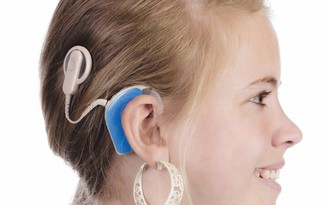 Cấy điện cực ốc tai trị điếc