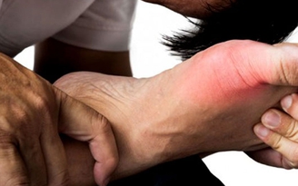 Trái Cherry - giải pháp mới giúp điều trị bệnh Gout