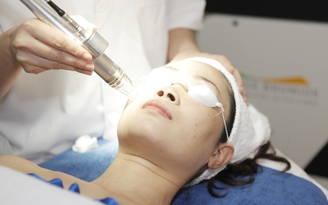 Trị nám da mặt bằng tia laser có an toàn không?