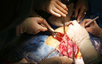 BV ĐH Y Dược TP.HCM: Phẫu thuật lấy khối u ổ bụng lớn 'top 5 thế giới'