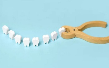 Phải làm gì khi răng khôn bị nhiễm trùng?