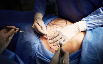 Bệnh nhân tử vong nghi do hút mỡ ở Bệnh viện thẩm mỹ Sao Hàn TP.HCM